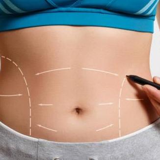 Liposuction in Riyadh